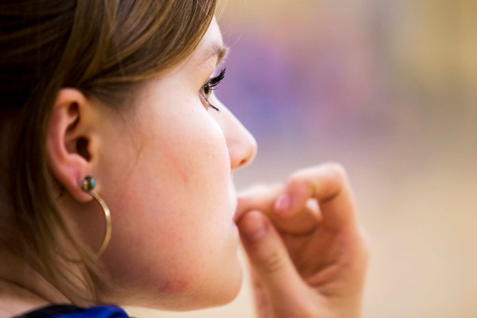 Some habits are harder to bite