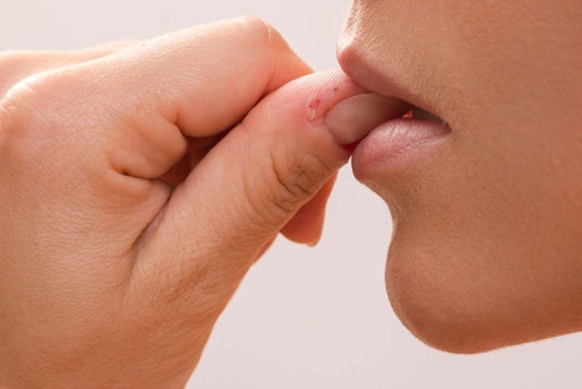 Cracking Anxious Habits Are Trying to Tell You